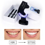 Tannbleking Før og etter bilde SkinUp Tannbleking Kit med trådløst LED lys